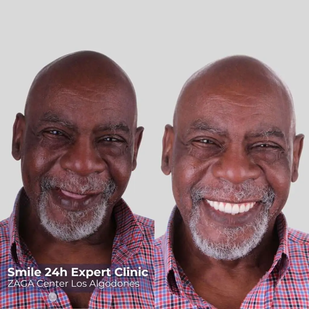 Before After Patient