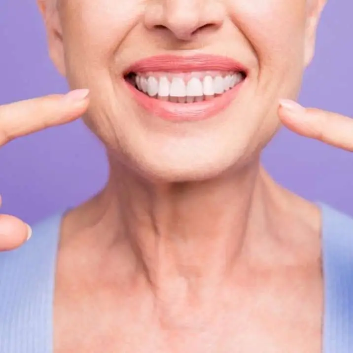 Smile dental implants
