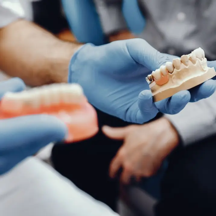 Denture Implants Full