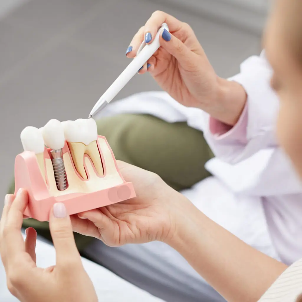 Dental Implant Education