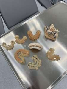 Guides chirurgicaux pour les implants dentaires - Guided Surgery